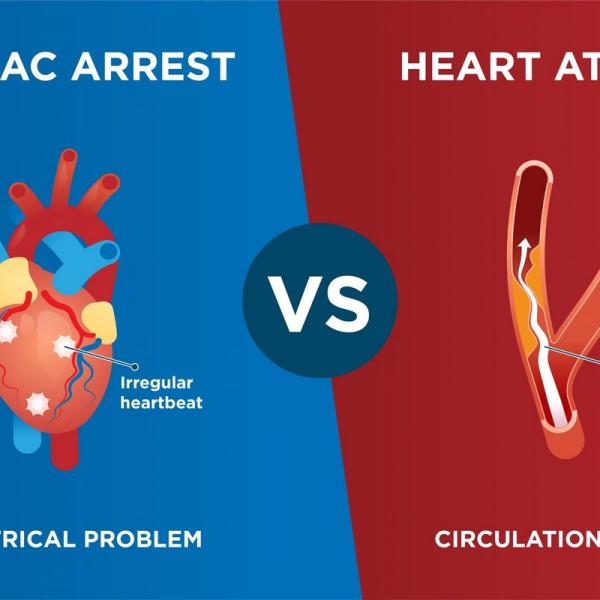 Care este diferența dintre stopul cardiac și atacul de cord?