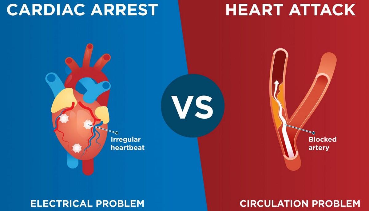 Care este diferența dintre stopul cardiac și atacul de cord?