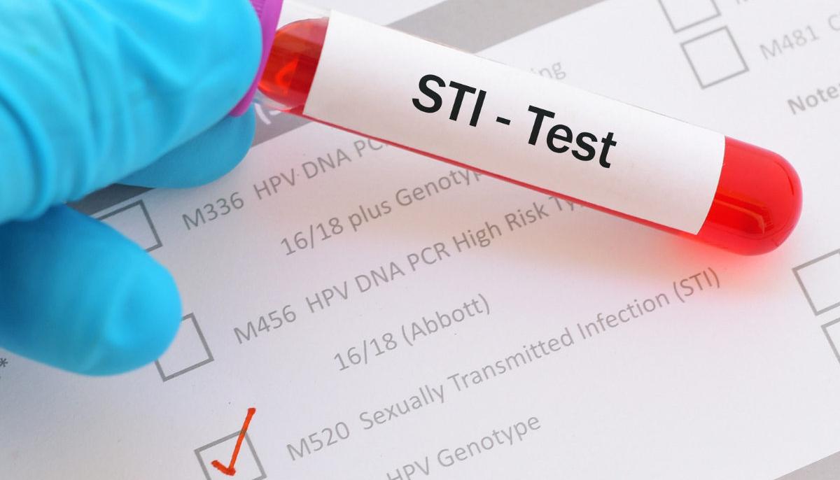 Pregnancy and sexually transmitted diseases